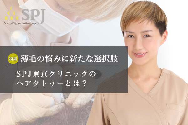 薄毛の悩みに新たな選択肢 ヘアタトゥーの実力とは Dantes ダンテス 男性向け医療 健康情報サイト