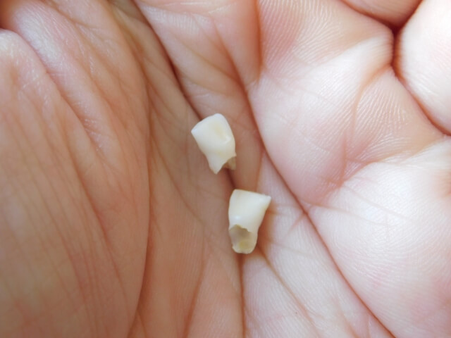 男の底力2021年1月14日乳歯