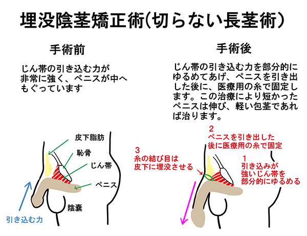 チンコ を 大きく する 方法