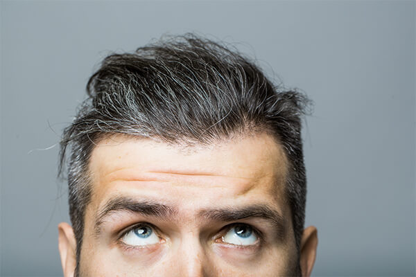 自分の髪の毛を引き抜く抜毛症は自毛植毛できるか？