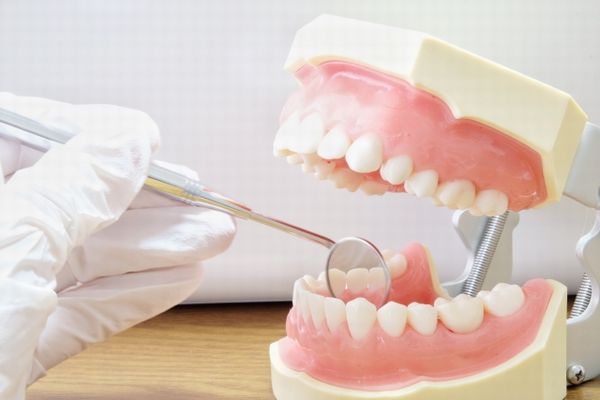 歯を綺麗にする方法